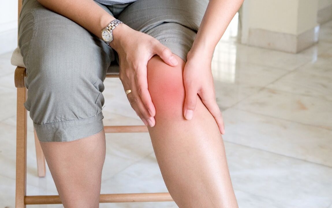 Inflamación con enrojecimiento en la articulación de la rodilla, un signo de artritis. 