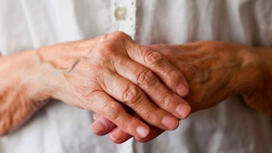 La artritis reumatoide causa dolor e hinchazón en las articulaciones de los dedos. 